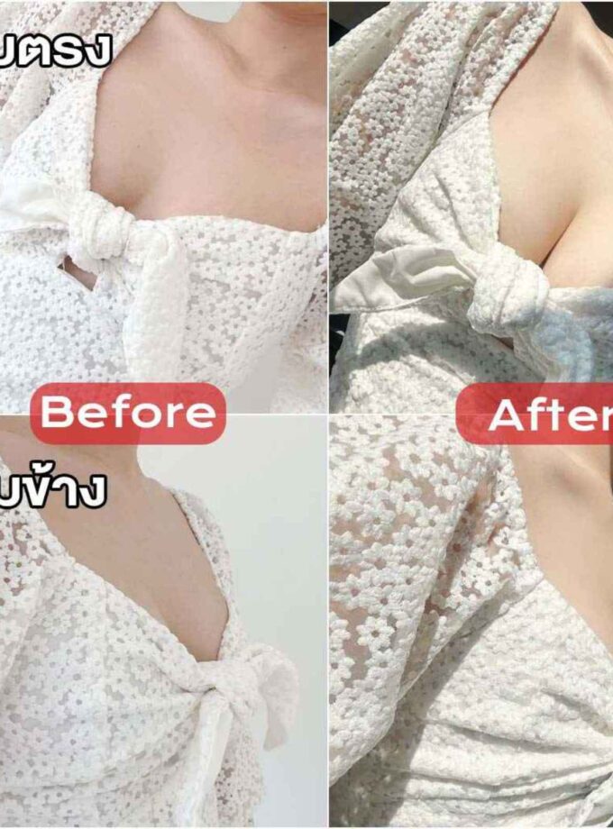 บราซิลิโคนดันทรง แบบยาว