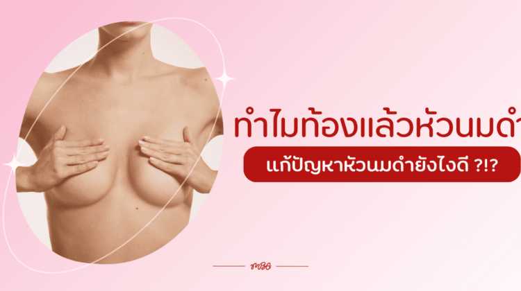 ทำไมท้องแล้วหัวนมดำ แก้ปัญหาหัวนมดำยังไงดี ?!?