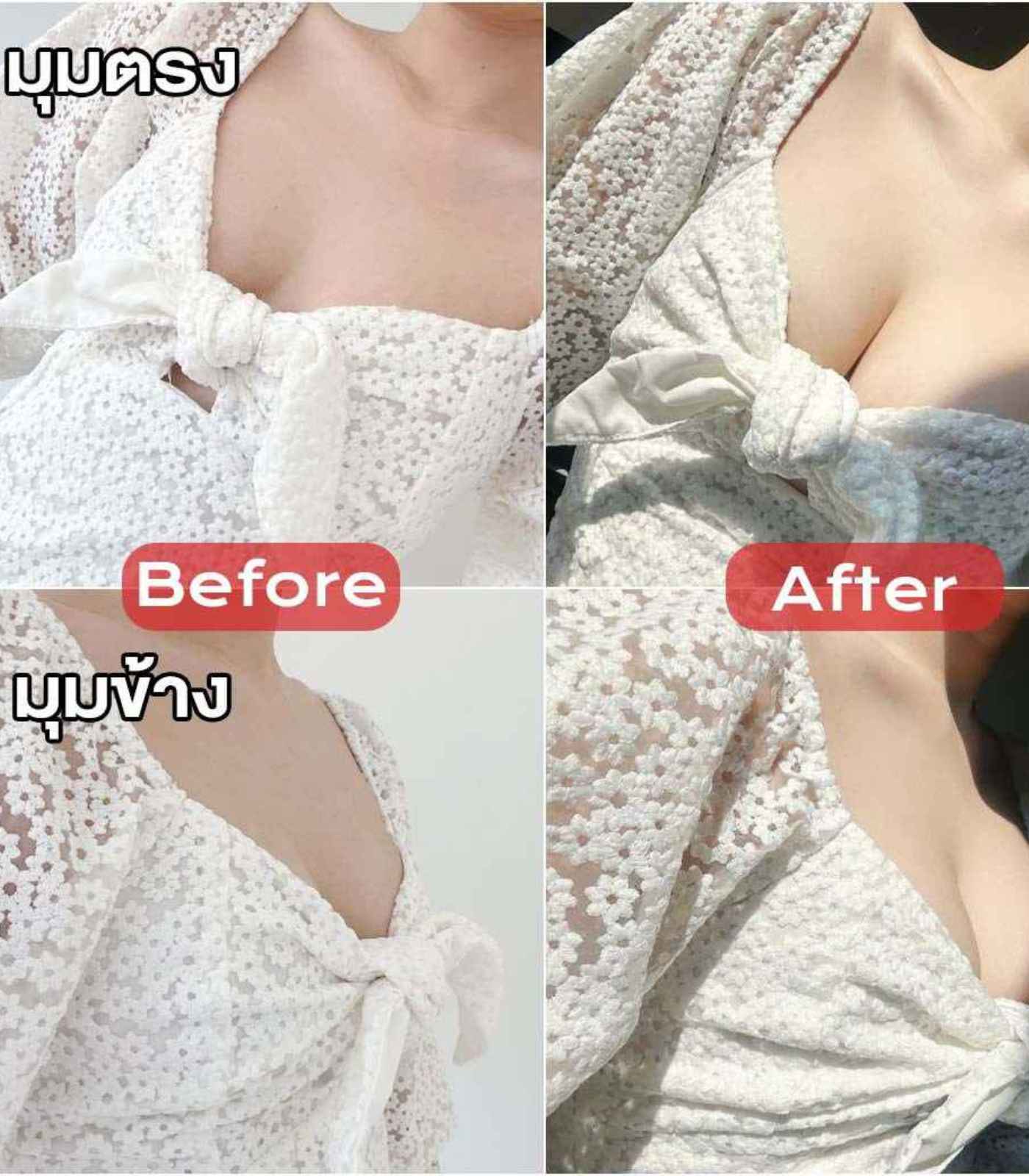 บราซิลิโคนดันทรง แบบยาว - Image 6